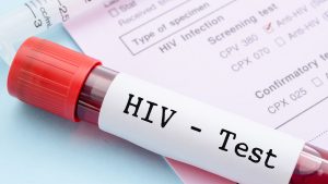 tube à essai marqué « HIV-test » contenant du sang